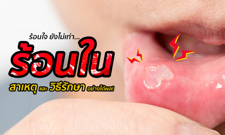 ฝี คืออะไร ใช่สิวหรือไม่ บีบเองได้ไหม? มาดูคำตอบ พร้อมสาเหตุ อาการ วิธี ...